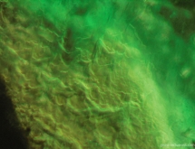 Gota de aceite effect emerald from Colombia